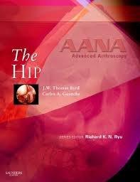 Hip Arthroscopy textbook co-written by Carlos Guanche, MD at Southern California Orthopedic Institute in Van Nuys, CA