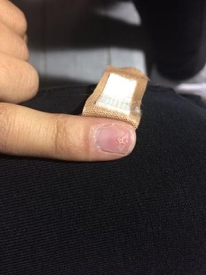 Punctured nail