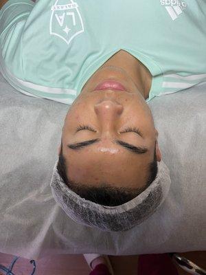 Teenagers love Hydrafacial because it's not traumatizing for their first time experience doing facials