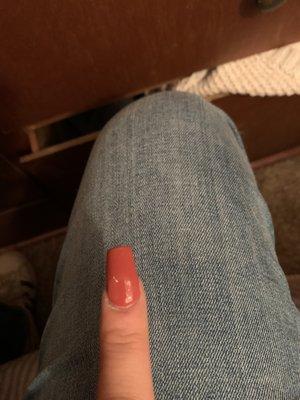 My crooked nail