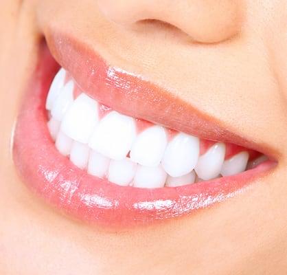 Gotta love those white teeth... Malibu Teeth Whitening will help make that happen!