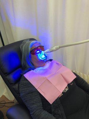 Teeth Whitening 1 hour section