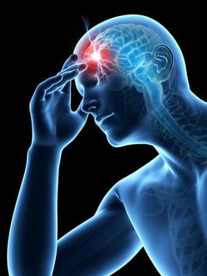 Long term migraine and tension headache relief using Janet Travell and David Simons, MD's Trigger Point Therapy protocols.