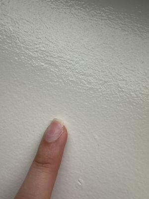 Nail that was ripped from the harsh removal