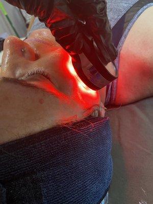 Red LED for fine lines and wrinkles