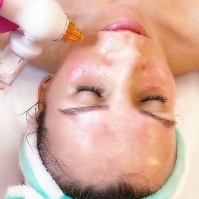 OXYGEN FACIAL