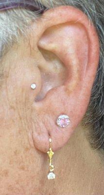 Tragus piercing (jewelry replacement)