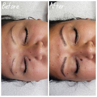 Microblading before and after