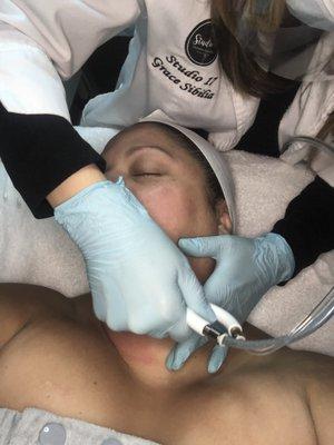 Microdermabrasion