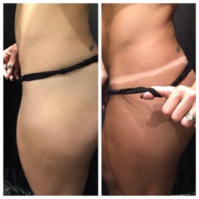 Before and After. Notice the tan helps the body look more tone.