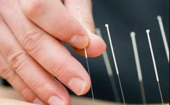 Acupuncture reduces Back Pain, Neck Tension, Joint Pain, Headaches, Eye Strain...; Improved Immune System; Relief from Digestive Conditions.