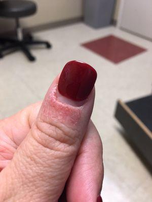 Got cut twice on the same thumb and turned into an infection. Will not be going back