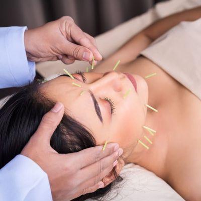 REJUVENATE FACIAL ACUPUNCTURE