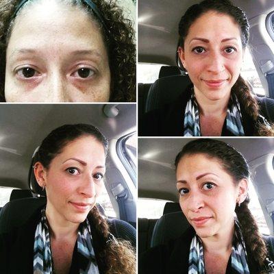 #eyebrowgameonpoint Before & After... I'm sooooo HAPPY! Thank you, Paola!