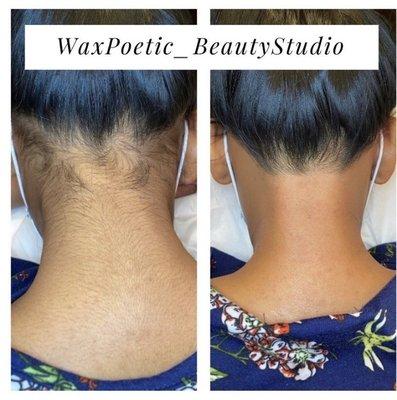 Before and after neck wax