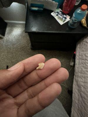 the tooth that was in the burrito