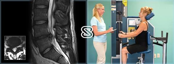 The SpineZone Program uses specific treatment protocols for disc herniations and bulges