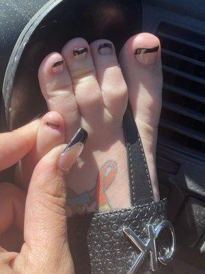 Bad pedicure job