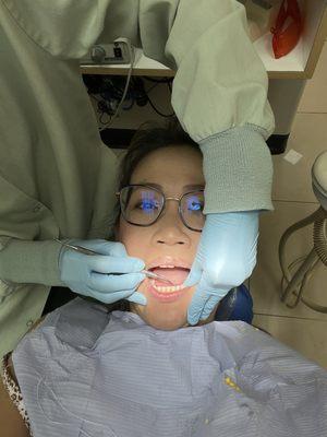 Final fixing up before finalizing with Invisalign