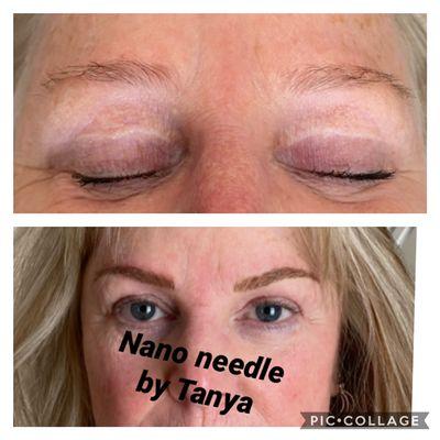 Nano needle are hair line strokes that last much longer than micro blading.