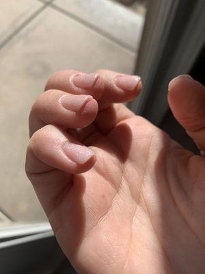 Looks thick, uneven and cuticles are jagged