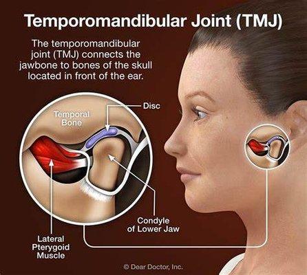 Stop TMJ pain with acupuncture.