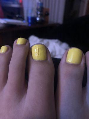 Gel pedicure