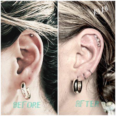 Repaired crooked 2nd lobe, 3rd lobe closed & repierced, 2 new bottom helix, changed out 3rd top helix w/ 14k solid white golds blings