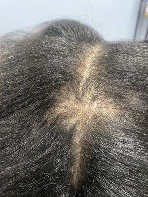 Bald spot due to blowout.