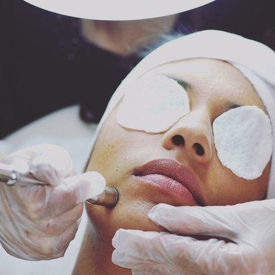 We offer special pricing on microdermabrasion packages! Call for pricing :)