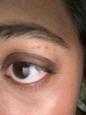 cuts under brow