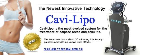 Cavi Lipo ... Blast the Fat!