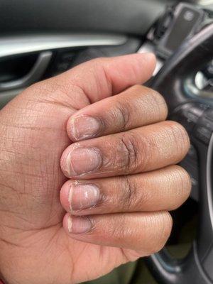 Nails after soak off.