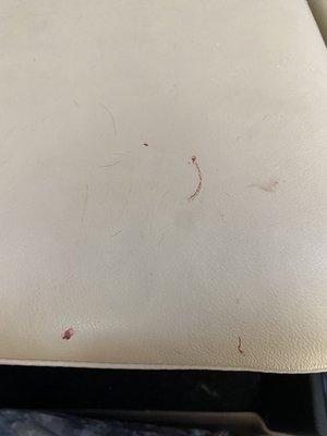 Blood on car seats