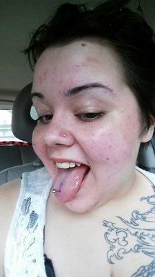 Tongue piercing by JR (the tear in front is from the previous piercing)