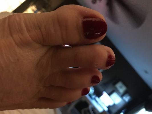 Horrible pedi job!!