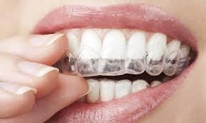 Elite Invisalign Provider