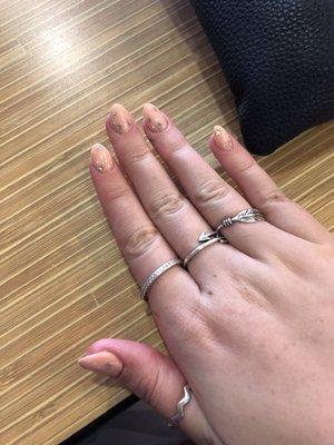 Look at thumb? Terrible nails for $80!