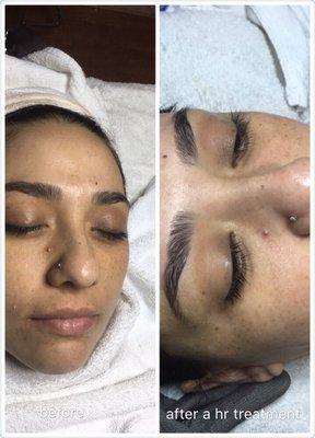 after treatment a hr her face $120 and include products take care her skin at home day time and night time