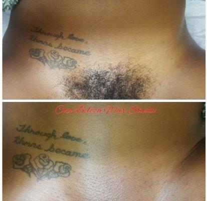 Before & After Brazilian Wax