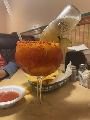 Coronarita