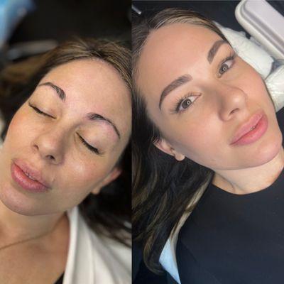 Before and after nano and powder brows