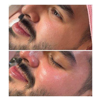 Pore refining facial and enzymatic brightening treatment