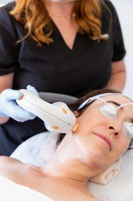 Ultherapy: the gold standard for collagen boosting and tighter, more toned looking skin.