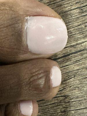 Look at big toe cuticle area... sloppy job!