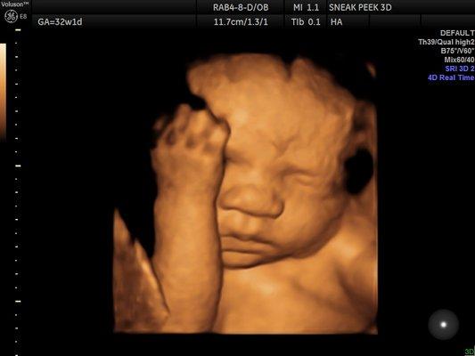 32 Week baby in 3D