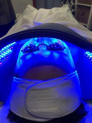 LED Light Facial (Hubby's facial )