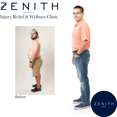 Before and after shots of a patient who lost 30 lbs on ZENITH's nutrition plan! Visit our website for more details.