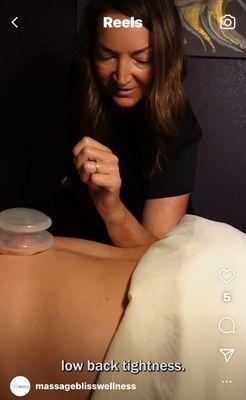 Cupping during your massage, and addressing low back tightness...