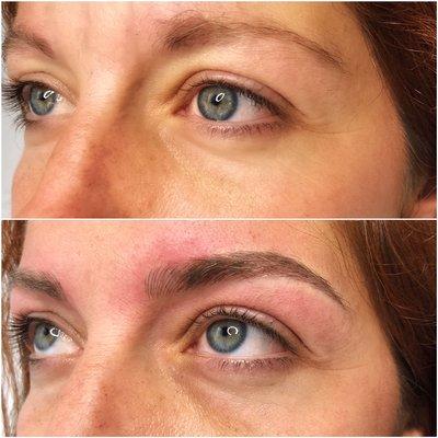 Microblading B&A